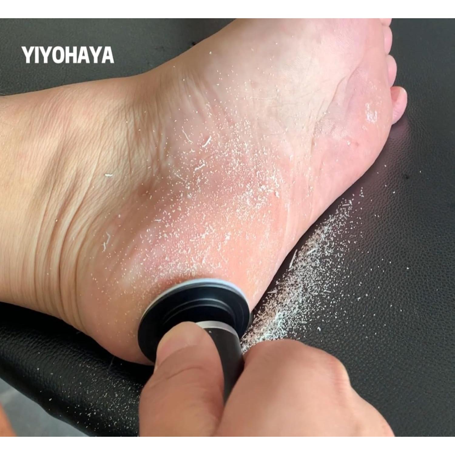 Removedor de Callos Eléctrico YIYOHAYA con 60 Discos de Lija