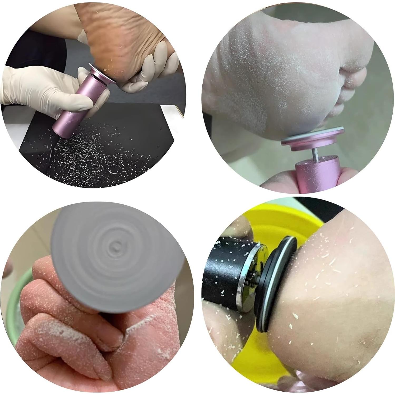 Removedor de Callos Eléctrico YIYOHAYA con 60 Discos de Lija