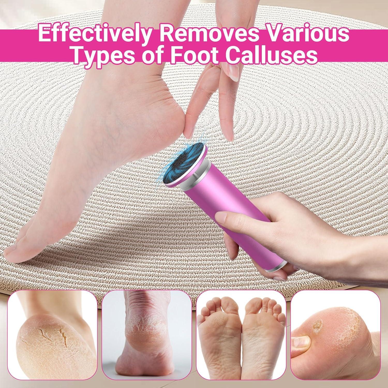 Removedor de Callos Eléctrico INTRO WILD con 80 Discos