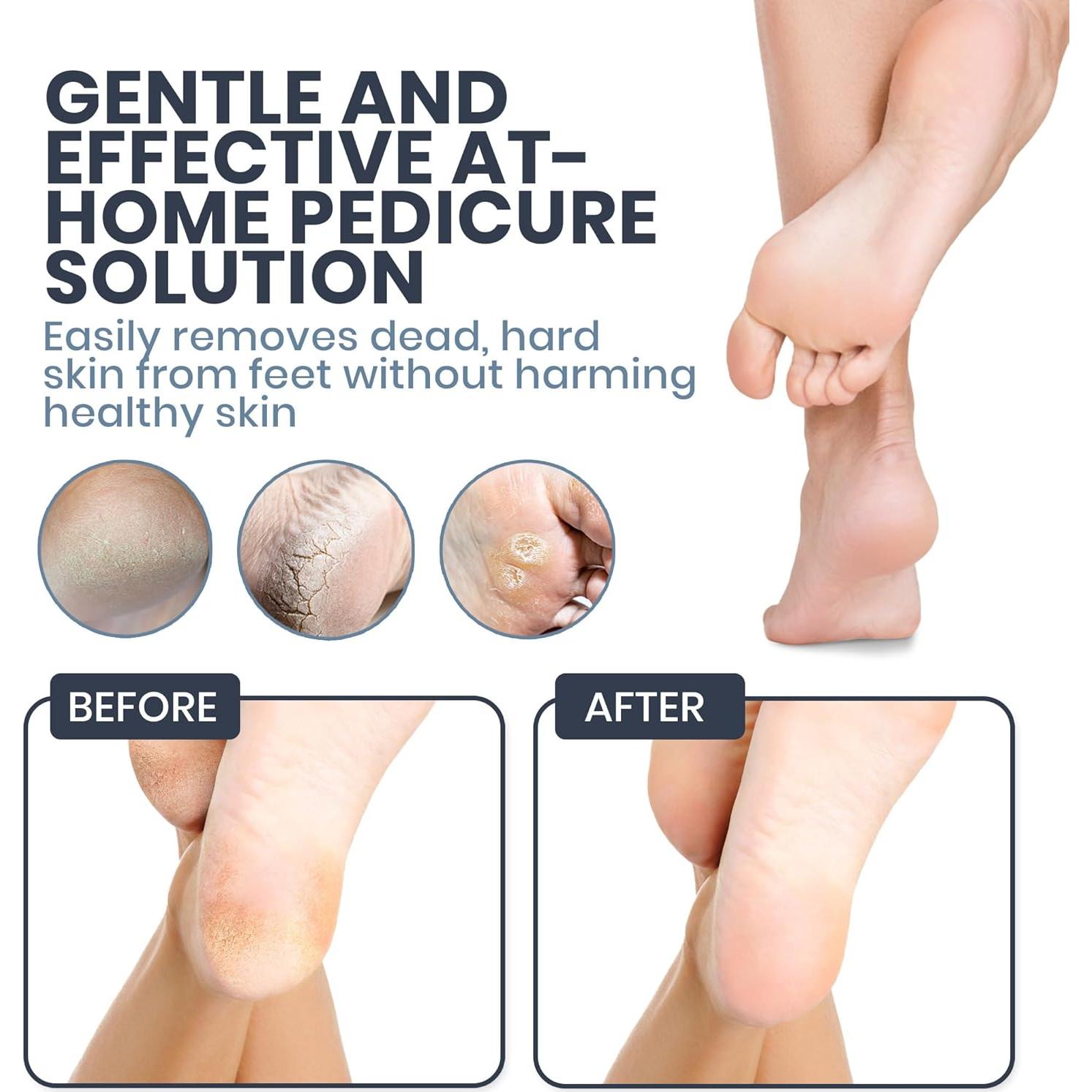 Lima Eléctrica SoleLux ECR001 con 60 Almohadillas y Velocidad Ajustable