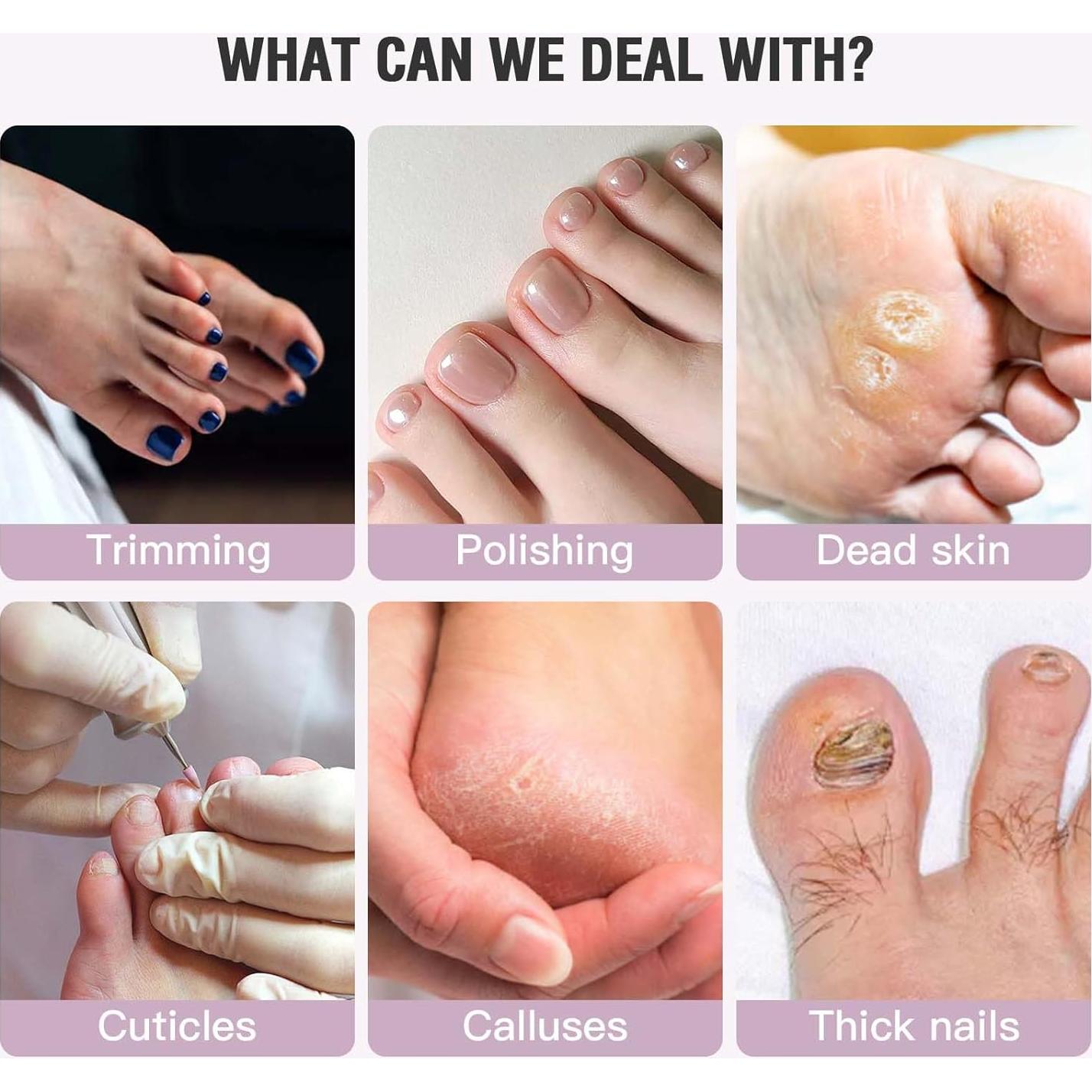 Removedor de Callos Eléctrico MFish Negro - 8 Cabezas, 9 Velocidades