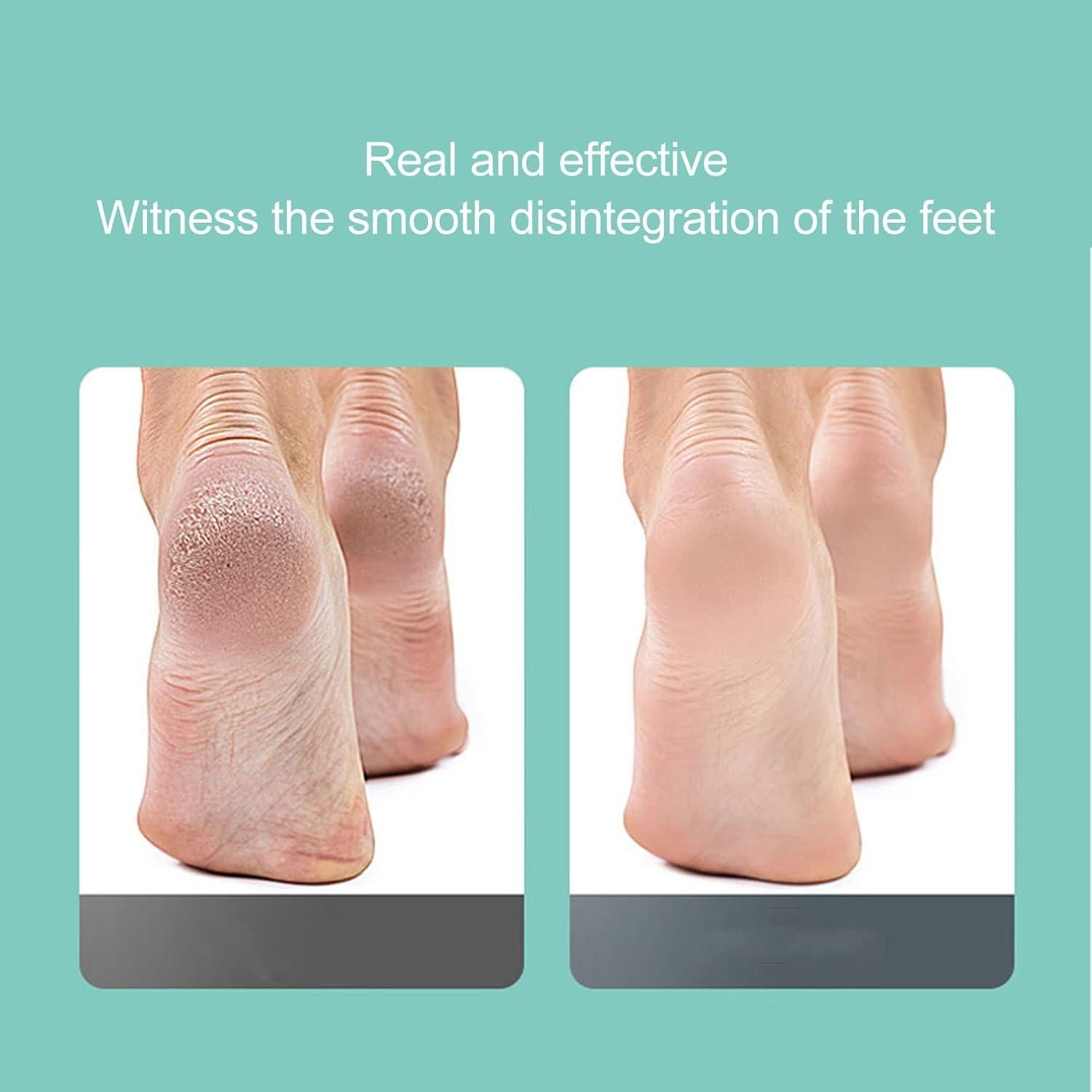 Removedor de Callos Eléctrico Yinhing USB, Lima Recargable para Pies