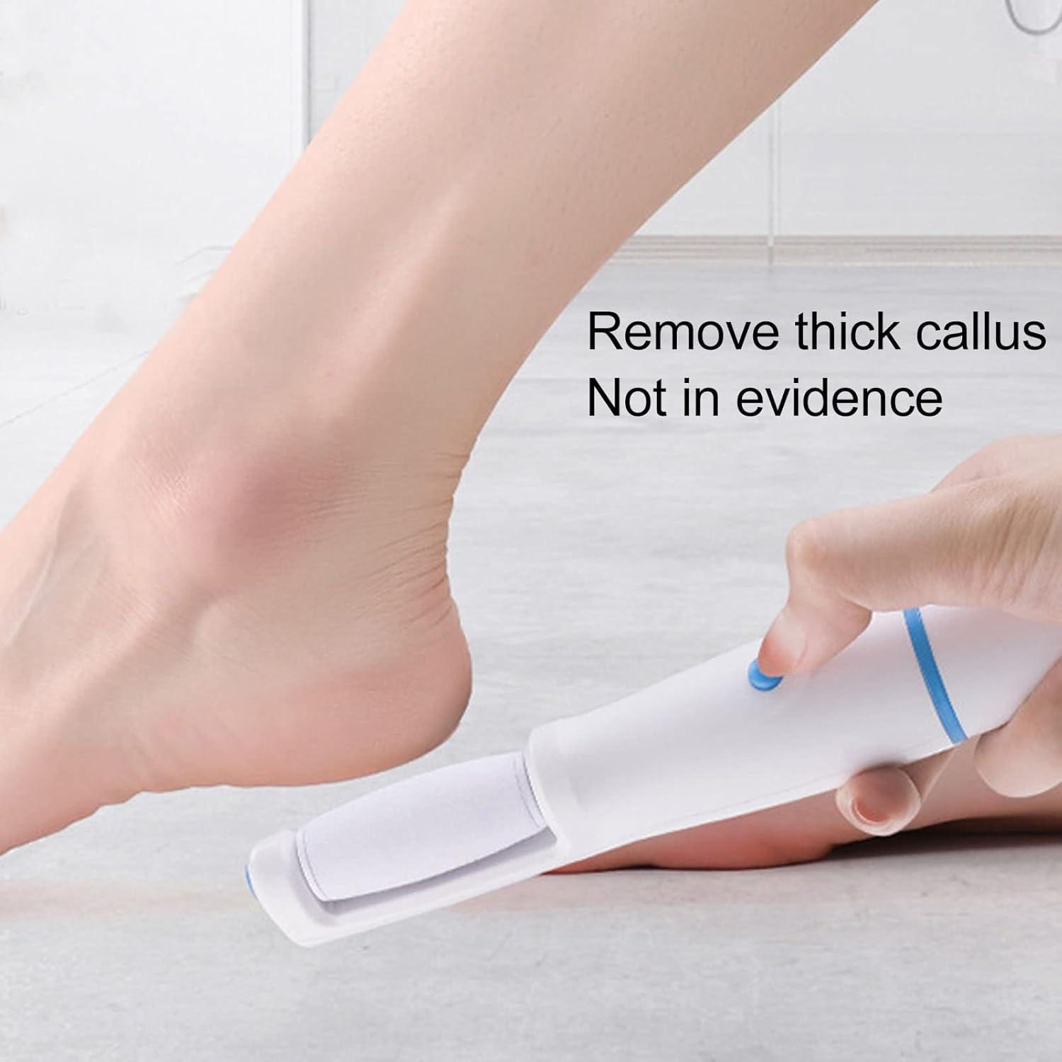 Removedor de Callos Eléctrico Yinhing USB, Lima Recargable para Pies
