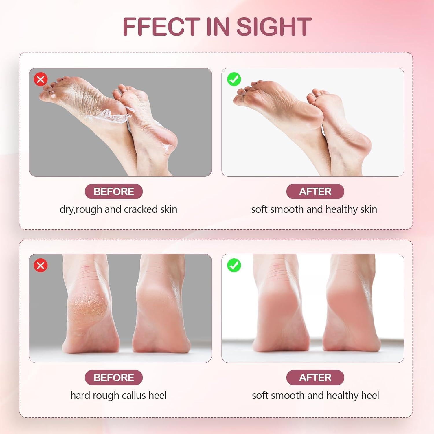 Removedor de Callos Eléctrico Recargable Dongguan 60 Discos