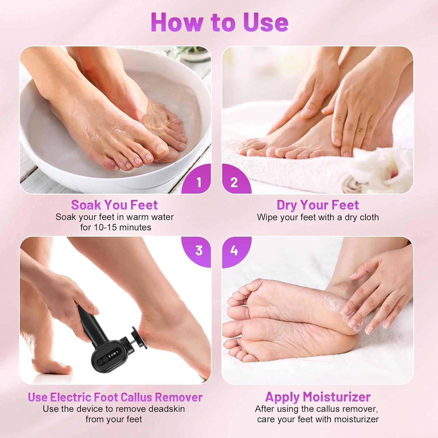 Removedor de Callos Eléctrico Recargable FVNANL 2 en 1