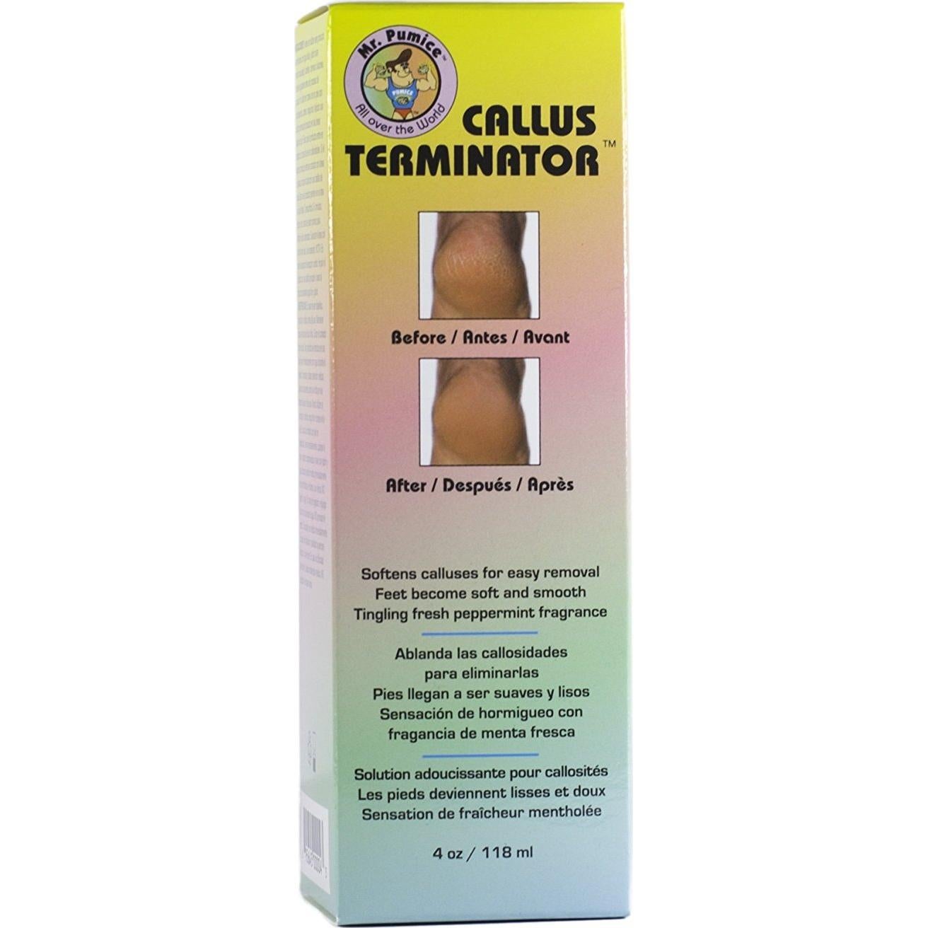 Terminador de Callos Mr. Pumice 113g - Suaviza Pies y Talones