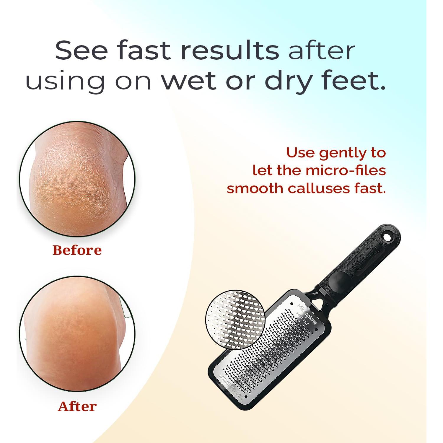 Raspador de Pies Microplane Colossal de Acero Inoxidable 27.5cm