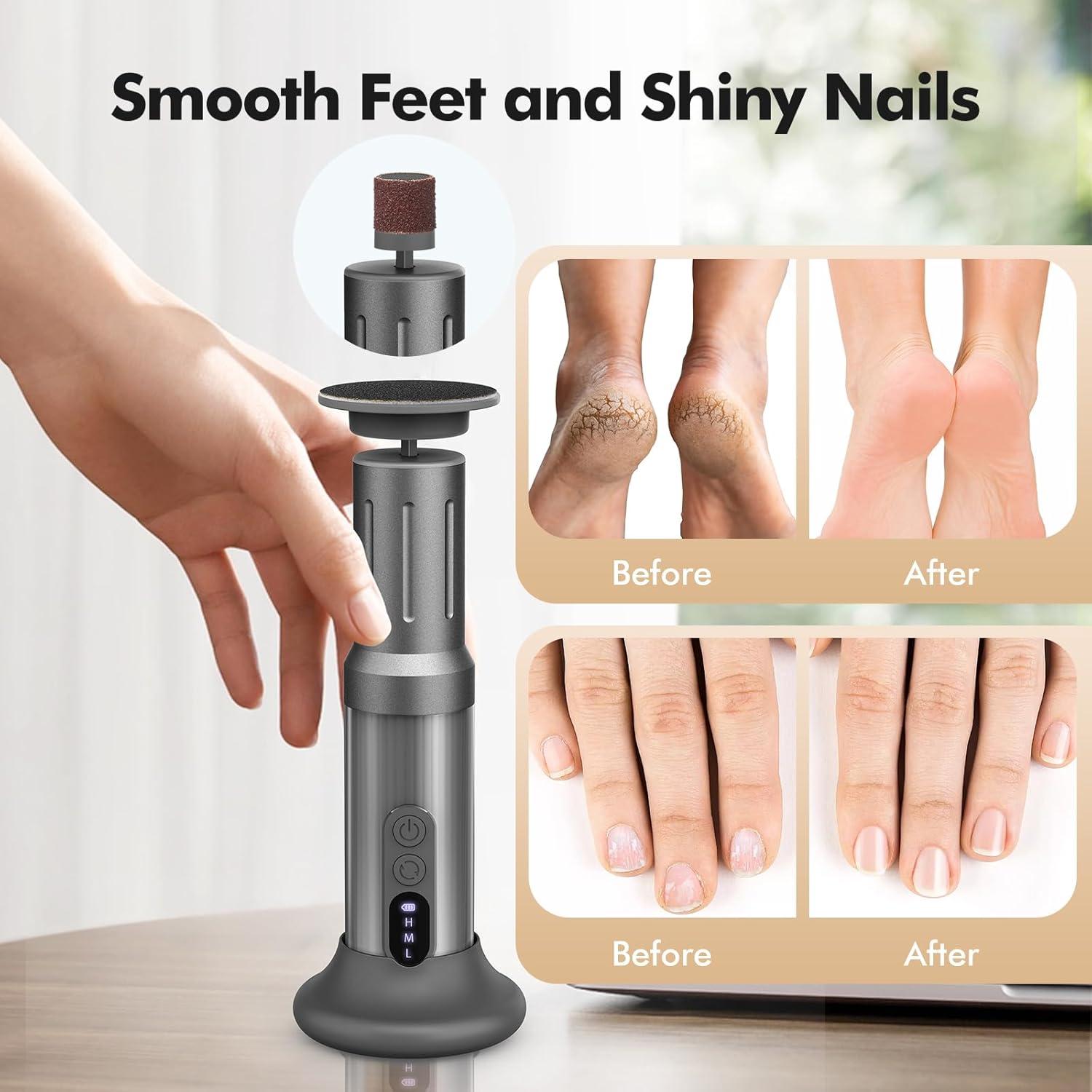 Removedor de Callos Eléctrico Inalámbrico Xisuoka C3 6 Velocidades