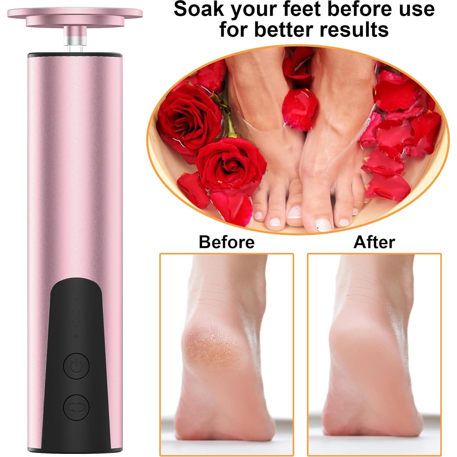 Lima Eléctrica para Pies ELEOPTION Rosa 6 Velocidades Recargable