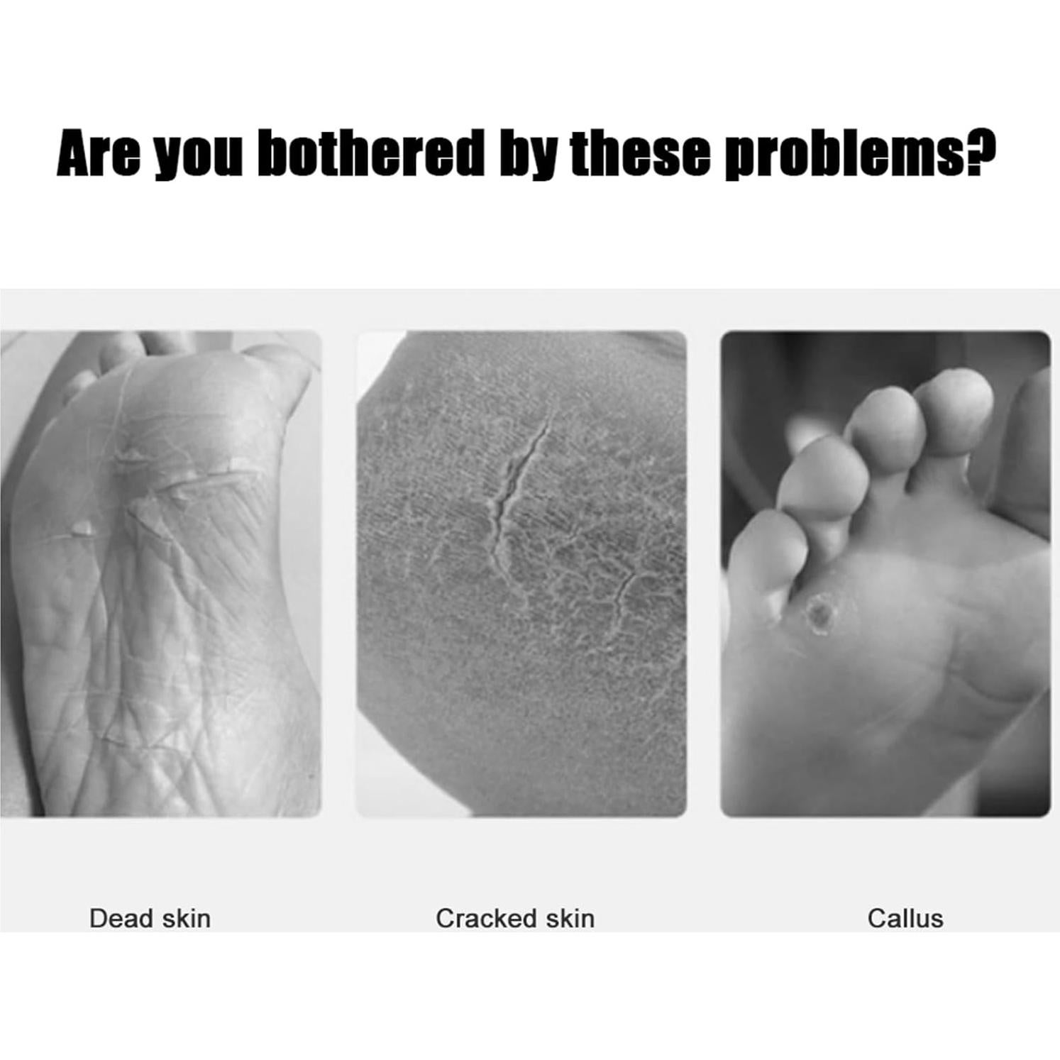 Lima Eléctrica para Pies KooingTech con 60 Piezas de Afilar