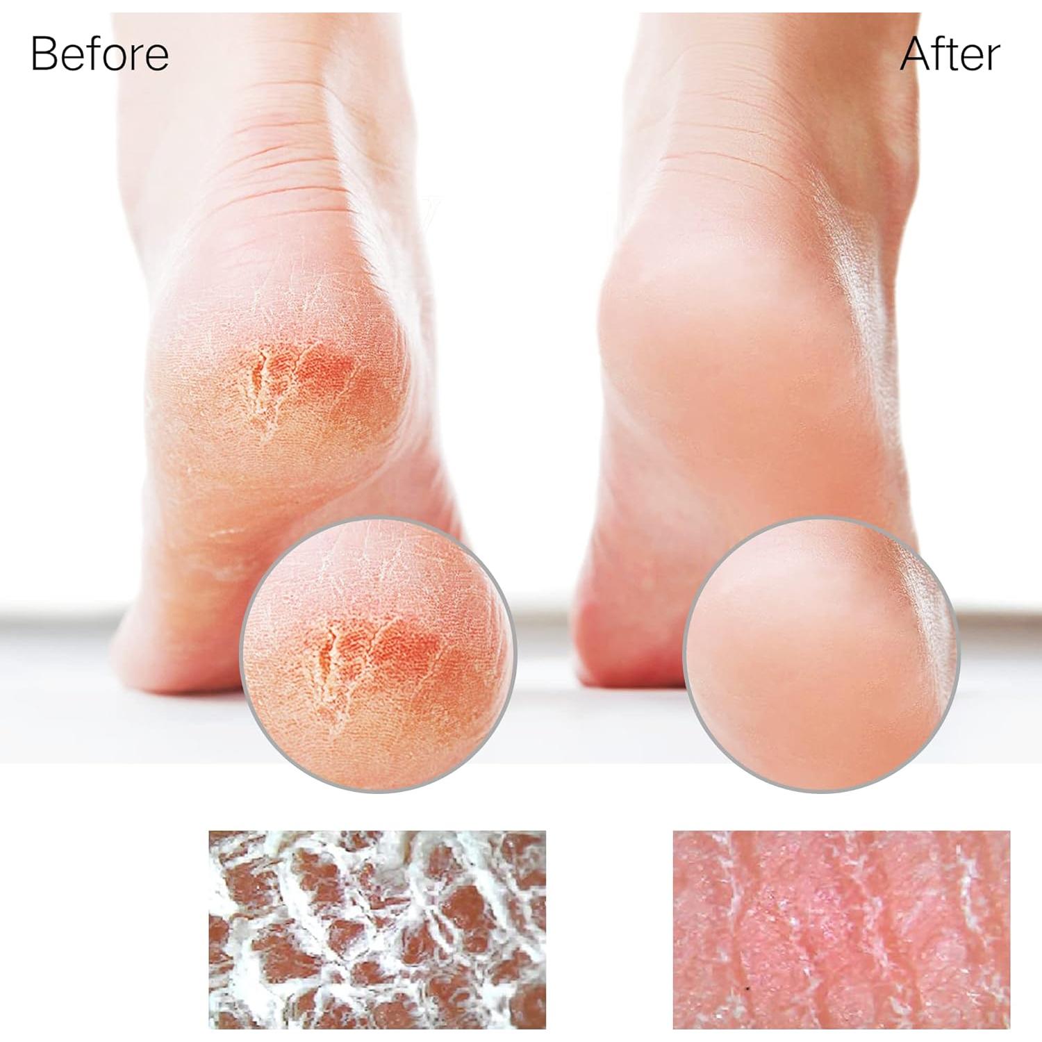 Lima de vidrio para pies Sunivaca - Removedor de callos 14x7cm