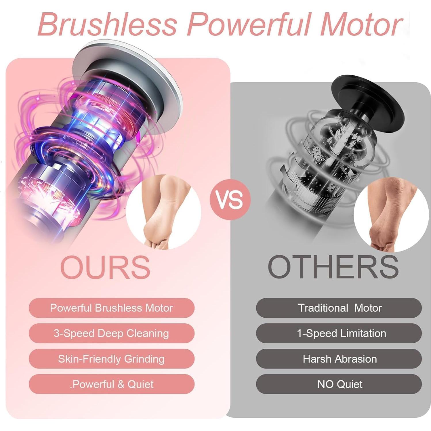 Removedor de Callos Eléctrico MGFO 3 Velocidades 2600mAh