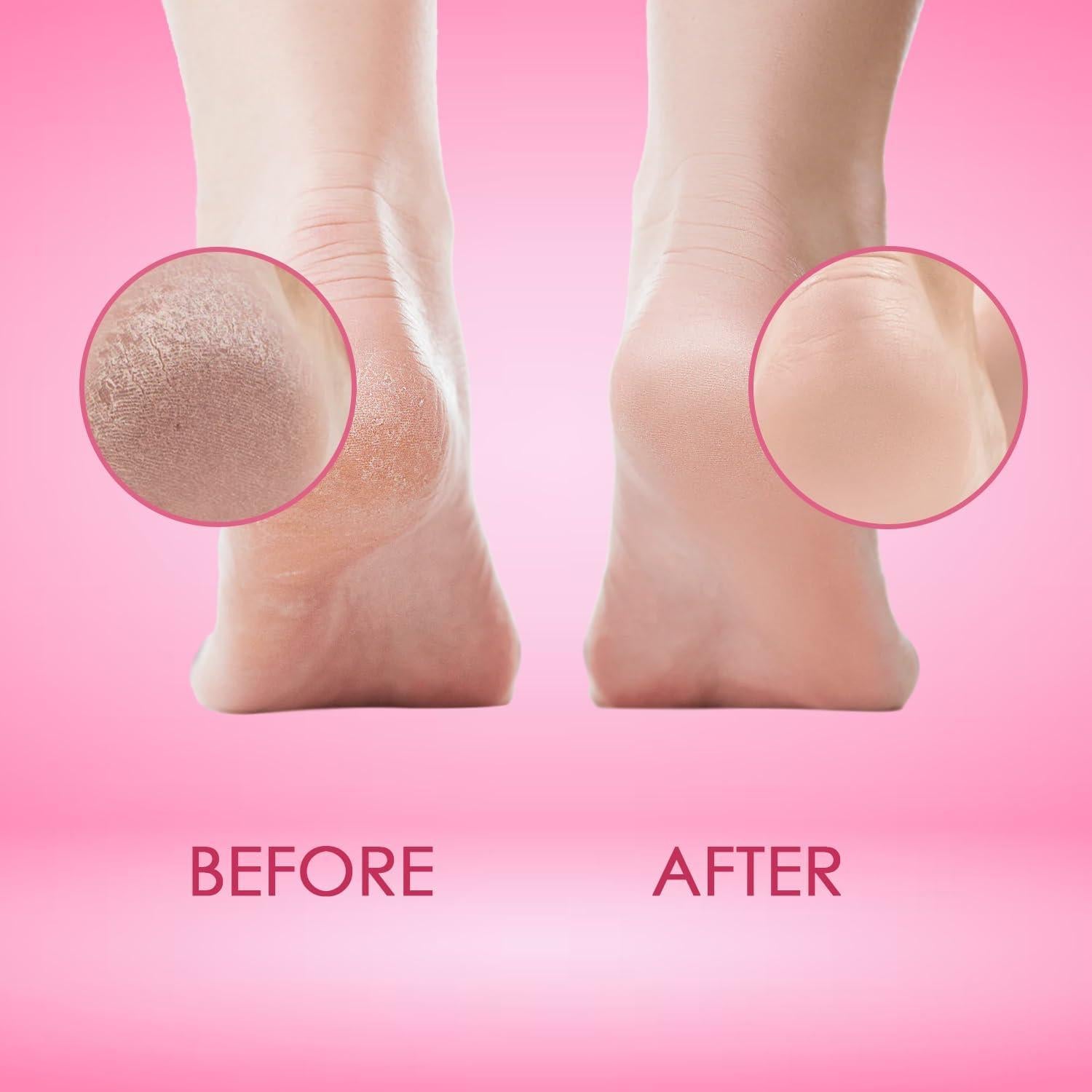 Gel Removedor de Callos Cutikles 30ml - Fuerza Extra para Pies