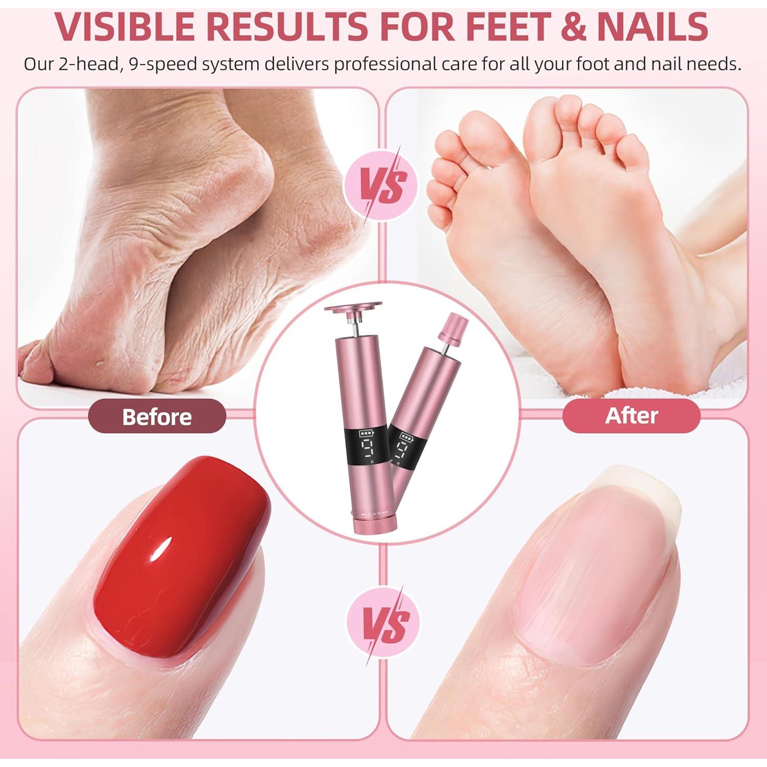 Removedor de Callos Eléctrico Bodybay MJQ 2-en-1 con Pantalla Digital