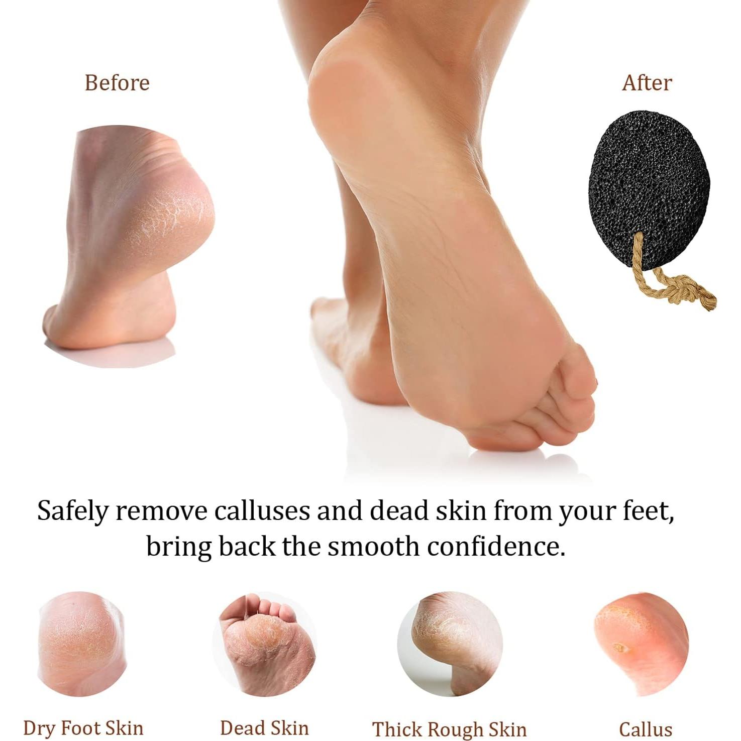 Piedra Pómez Natural Pumice Valley - Removedor de Callos 9x6cm