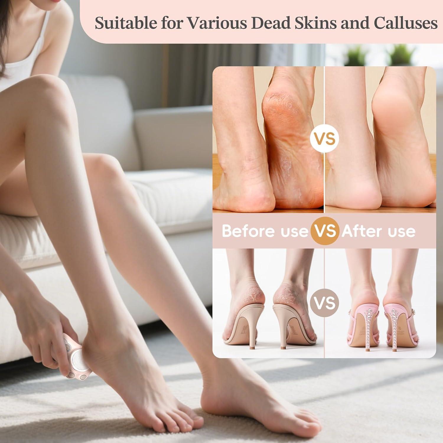 Removedor de Callos Eléctrico Tuudijy, 3 Velocidades, Pedicura Profesional