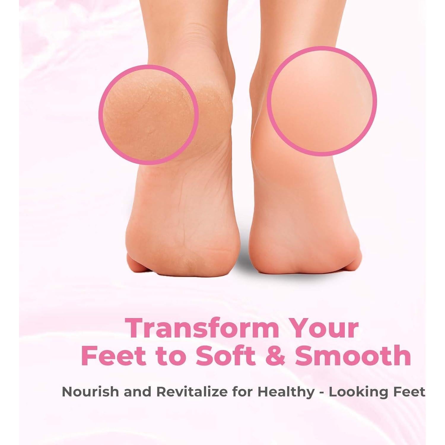 Removedor de Callos Saisze Gel Profesional 227g con Cepillo