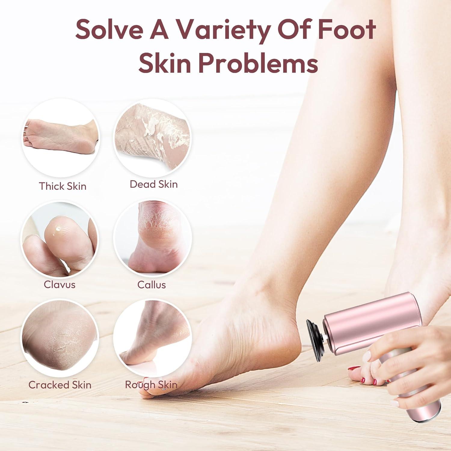 Removedor de Callos Eléctrico Drivox A8 Recargable 9 Velocidades