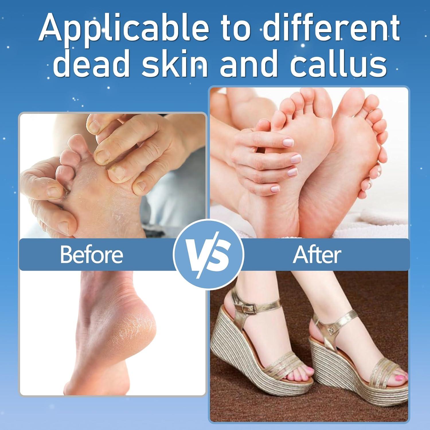 Removedor de Callos Eléctrico Jamestry 17 en 1 Impermeable