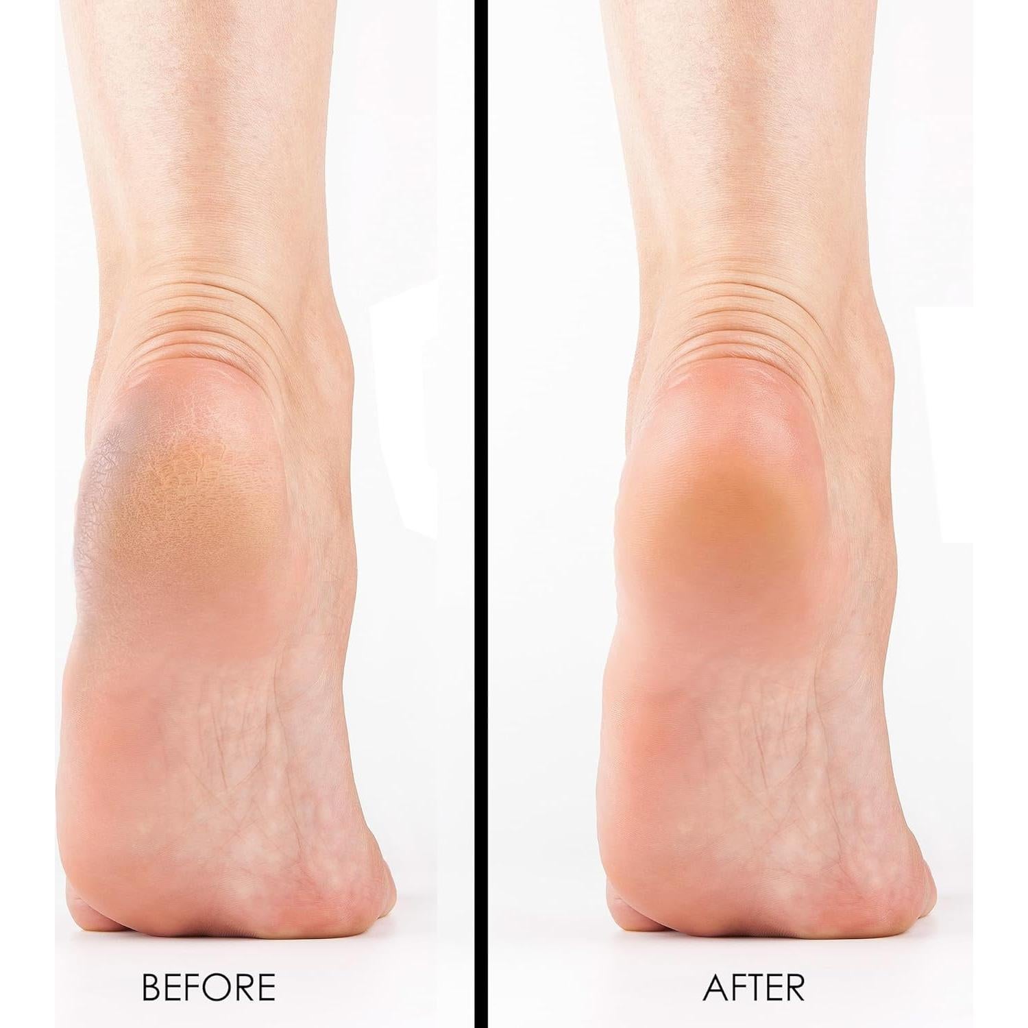 Piedras Pumice DeEnti - Paquete de 6 para Pedicura Profesional