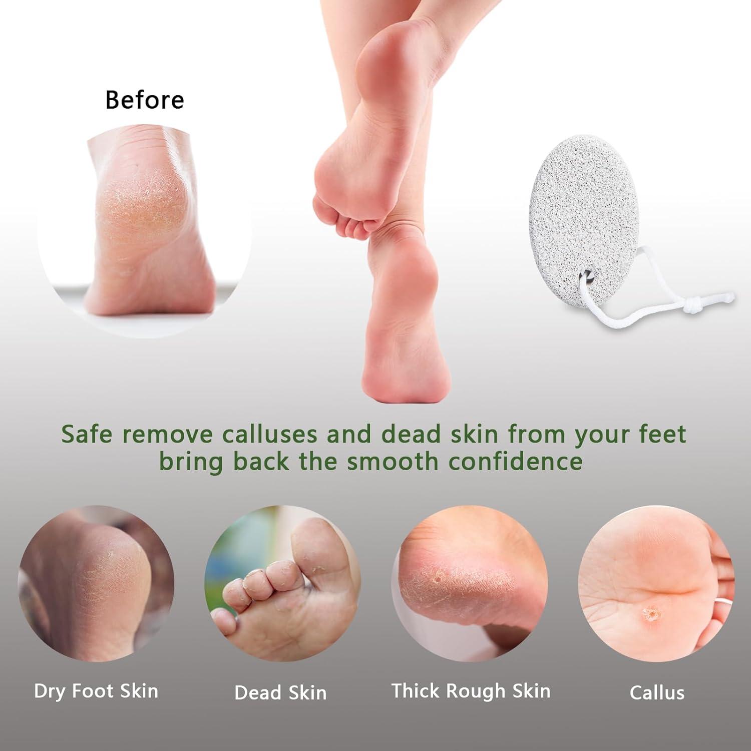 Piedra Pómez Natural Borogo para Pedicura - Paquete de 2