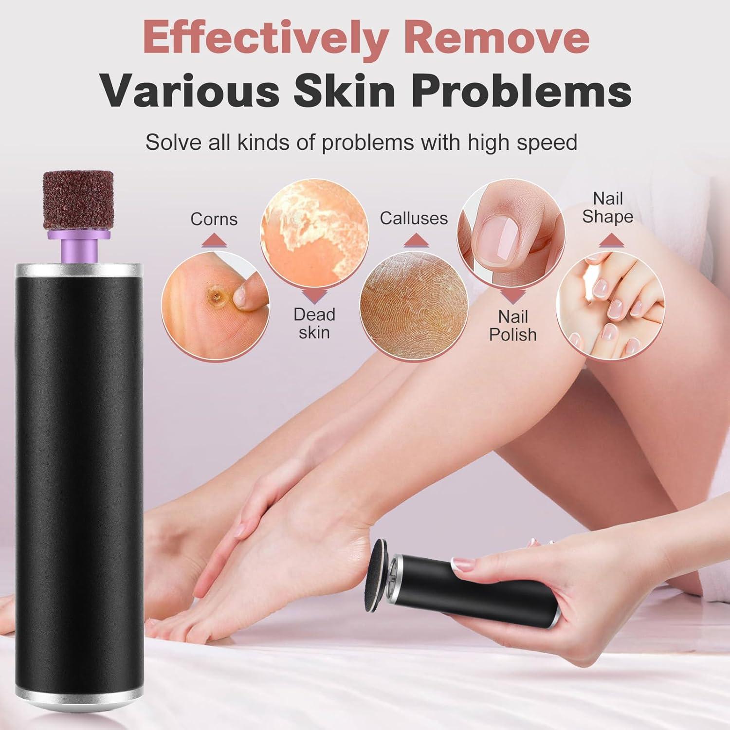 Removedor de Callos Eléctrico EDIFOLLY con Discos de Lija y Uñas