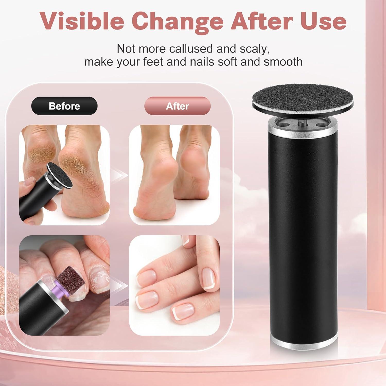 Removedor de Callos Eléctrico EDIFOLLY con Discos de Lija y Uñas