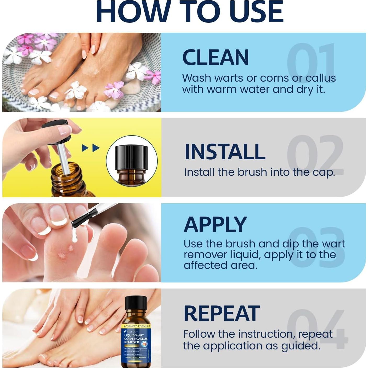 Removedor de Verrugas MEOLY 30 ML - Acción Rápida Ácido Salicílico