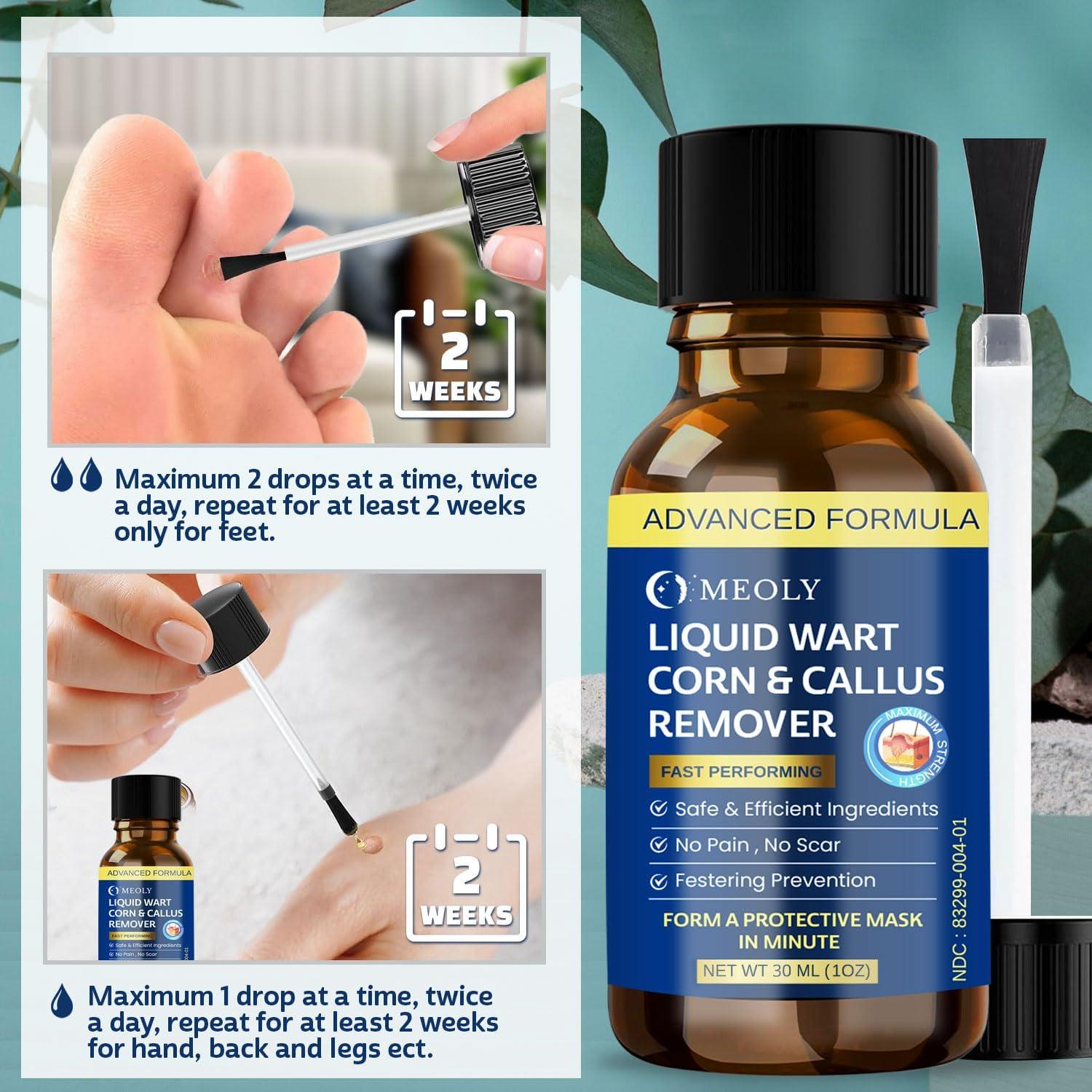 Removedor de Verrugas MEOLY 30 ML - Acción Rápida Ácido Salicílico