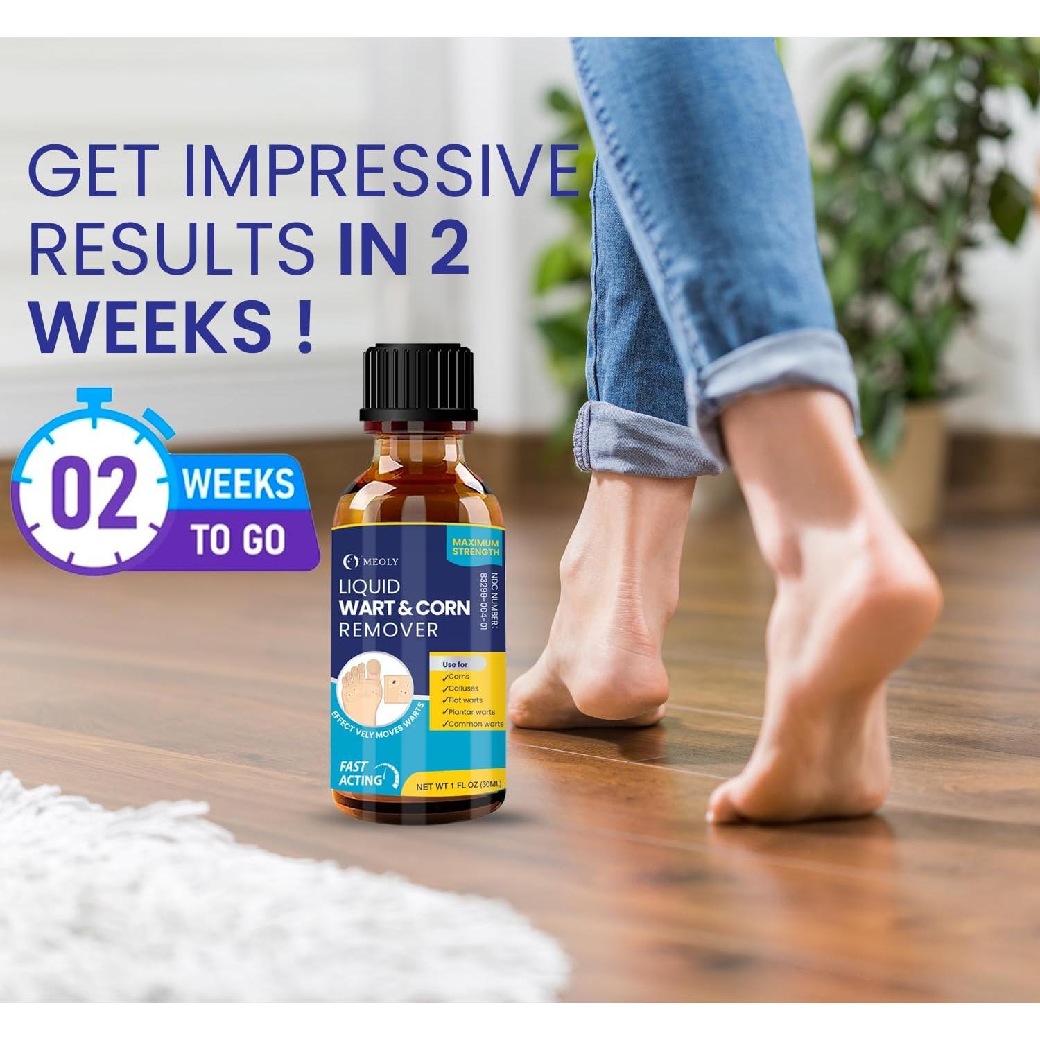 Eliminador de Verrugas Ácido Salicílico MOELY 30 ML Rápido