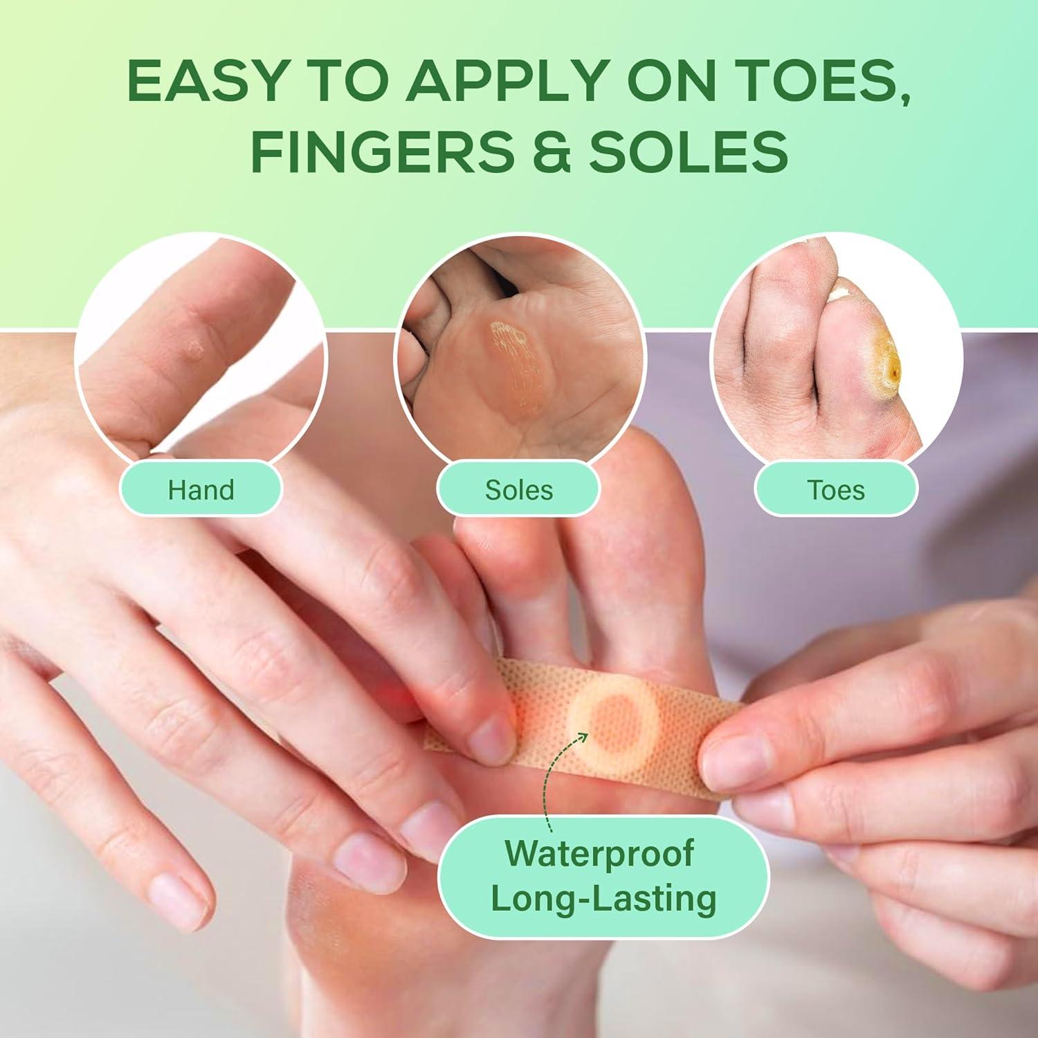 Almohadillas para Callos SupreH - 23 Unidades con 40% Ácido Salicílico