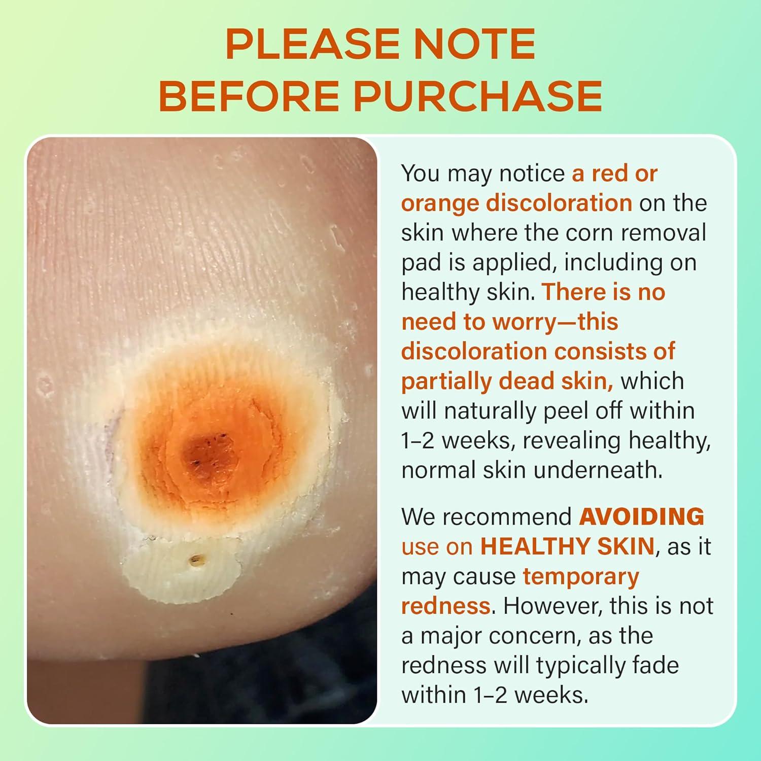 Almohadillas para Callos SupreH - 23 Unidades con 40% Ácido Salicílico