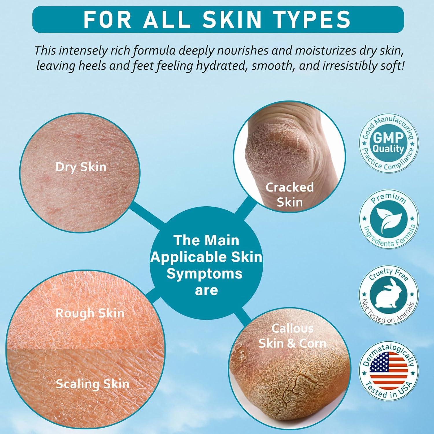 Crema de Urea 40% Aphesia para Pies Secos 150g - Hidratante