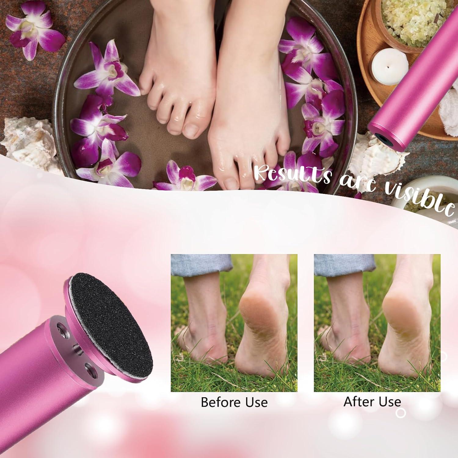 Removedor de Callos Eléctrico Dermave con 60 Discos de Lija