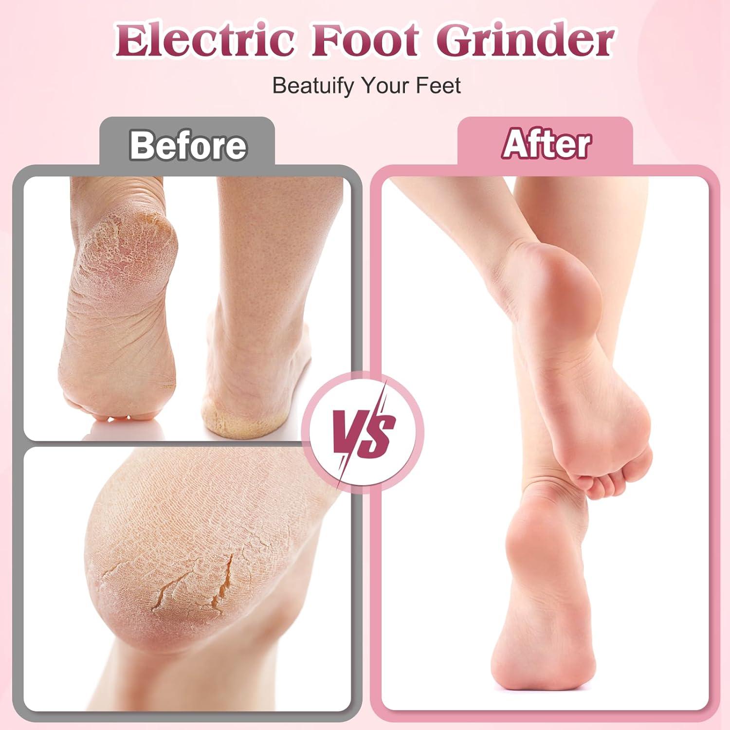 Removedor de Callos Eléctrico Wekashion con 60 Discos de Lija