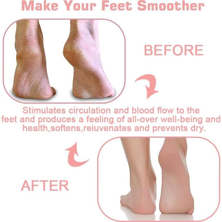 2PACK Alfombrilla Exfoliante para Pies VREOM con Ventosas 23x30cm