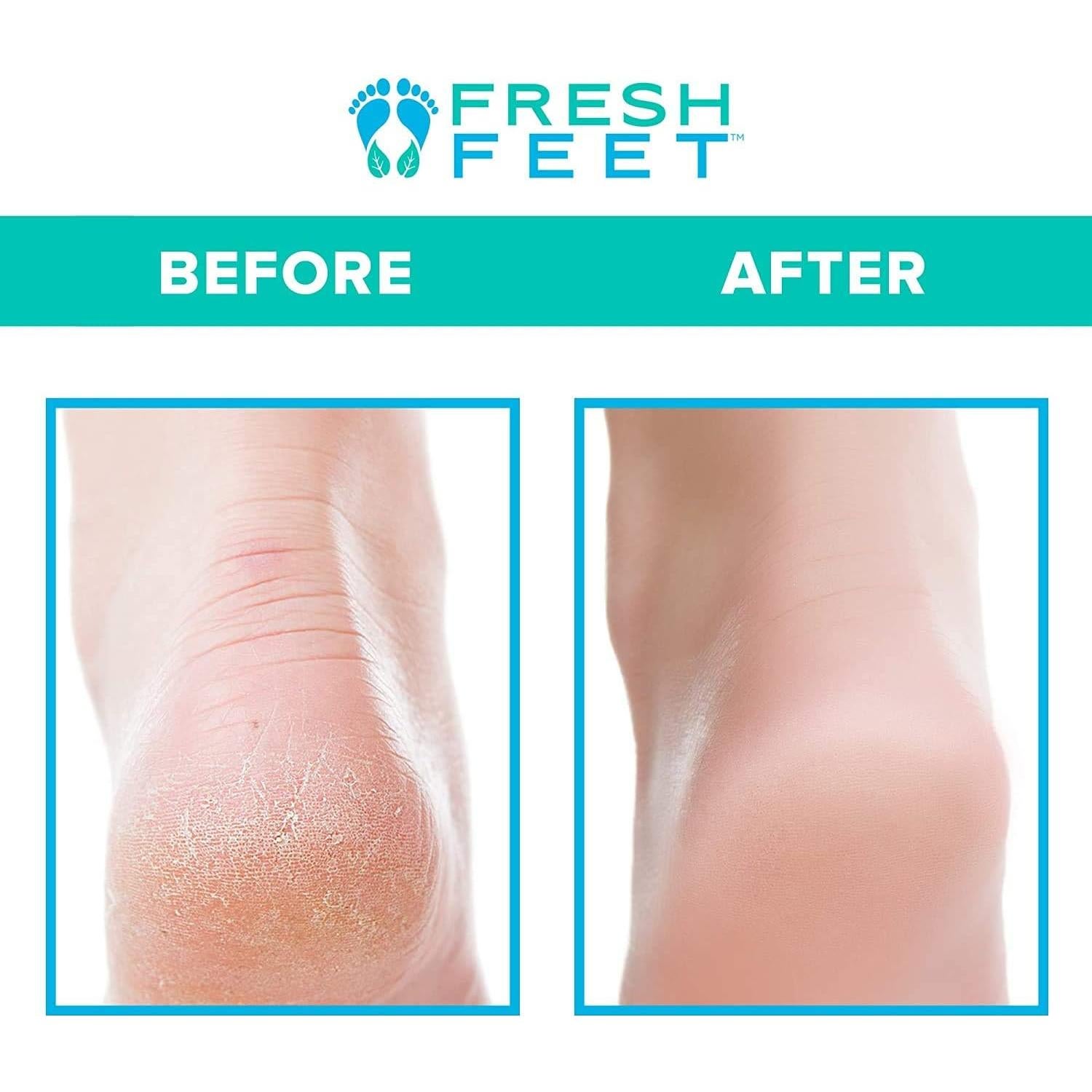 Limpiador de Pies Pies Frescos con Piedra Pómez - Spa en Casa