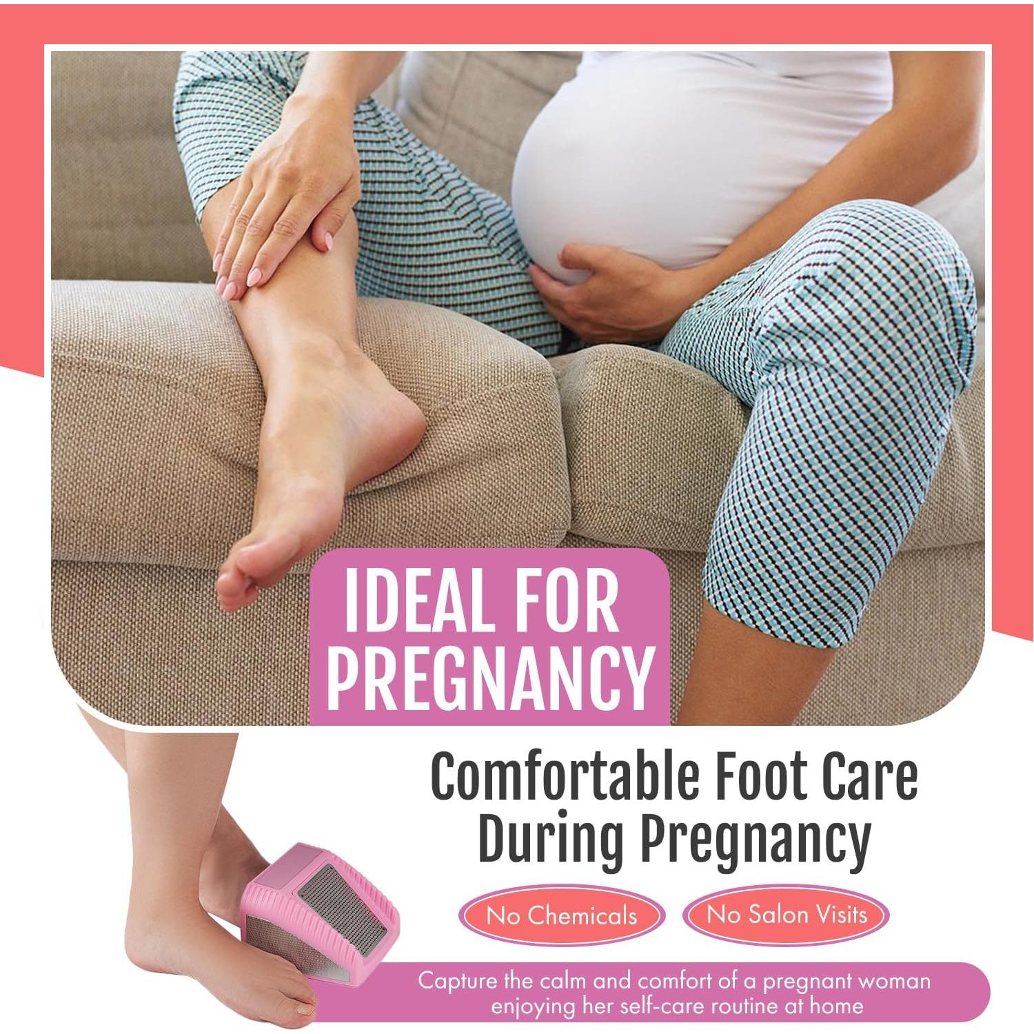 Exfoliador de Pies 3 en 1 Wonex Rosa - Removedor de Callos