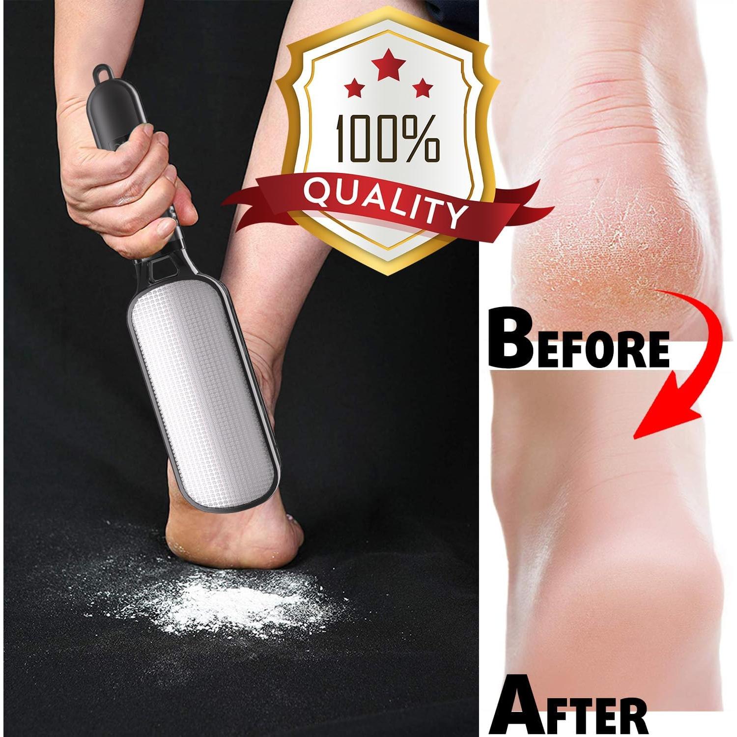 Lima para Pies Antonki 2 en 1 Doble Cara Exfoliante