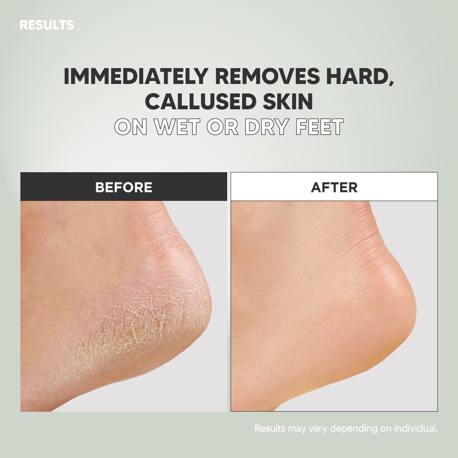 Lima de Pies Doble Cara F3 Systems - Pedicure Efectivo 2 Pcs