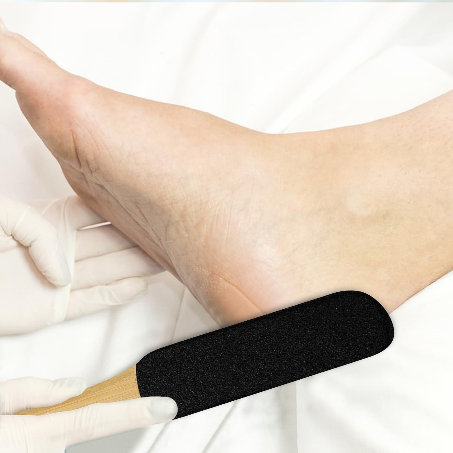 Lima Exfoliadora para Pies JIUZI 2Pack - Eliminador de Callos