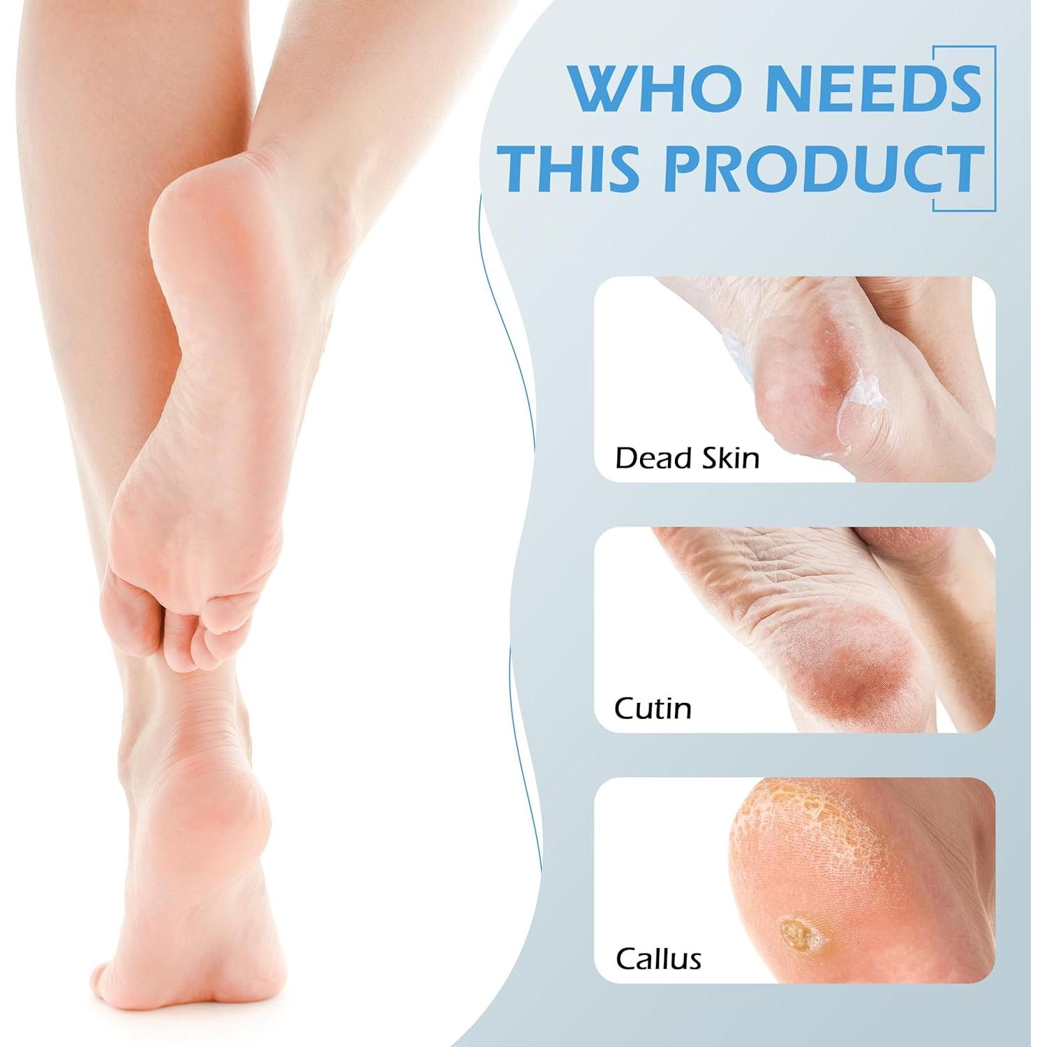 Kit 4 en 1 Cepillo para Pies Exfoliante con Piedra Pómez