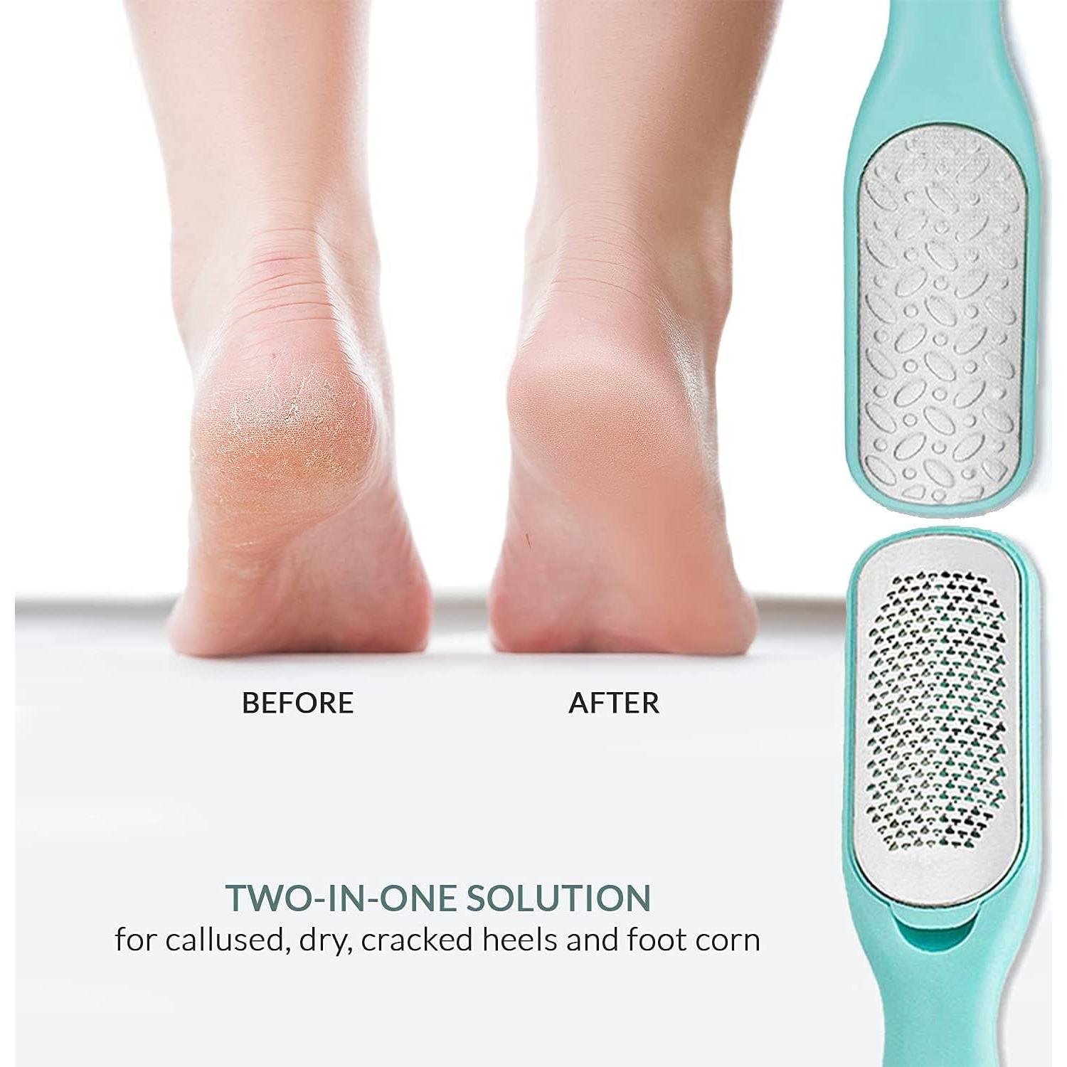 Removedor de Callos RelaxTony - Lima Doble Lado para Pies