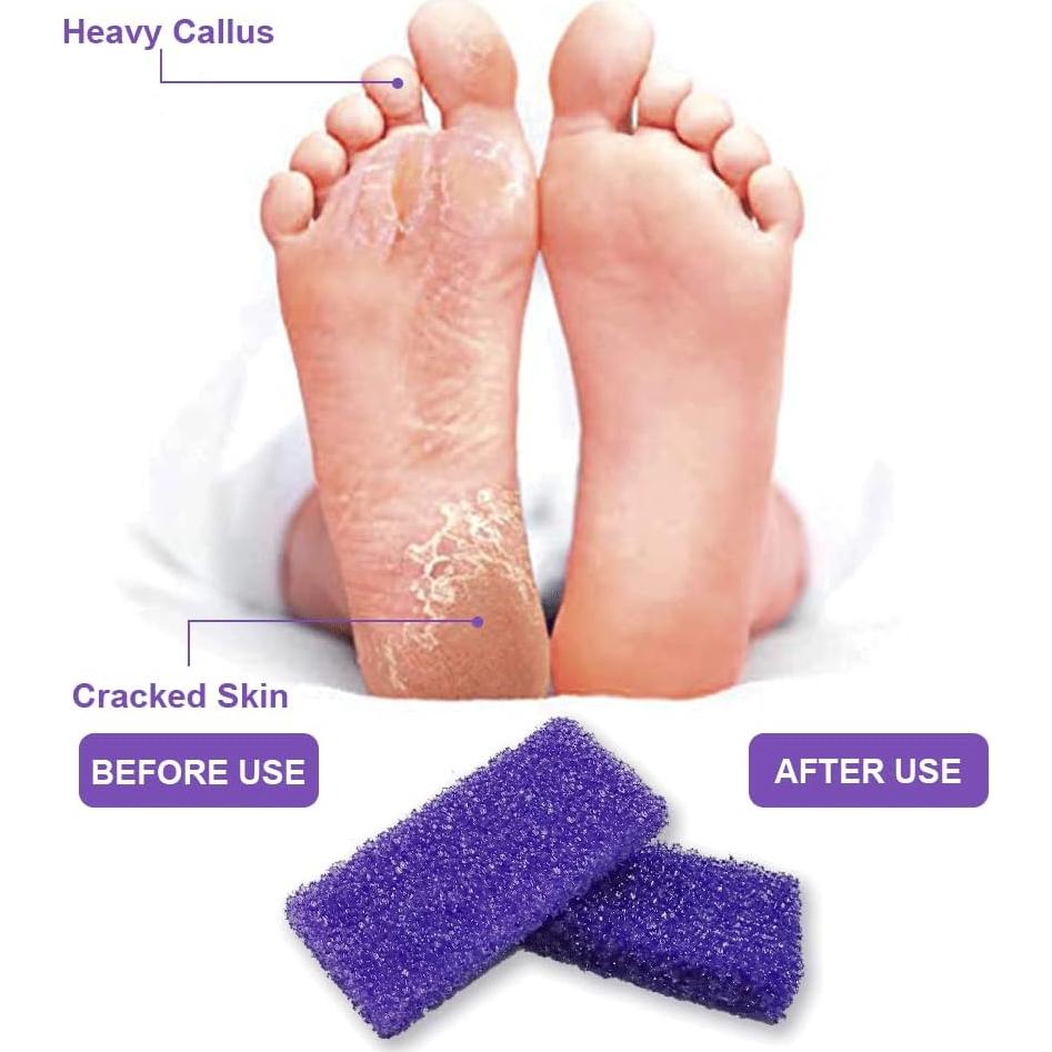 Piedra Pómez Exfoliante BPrettier para Pies - 40 PCS