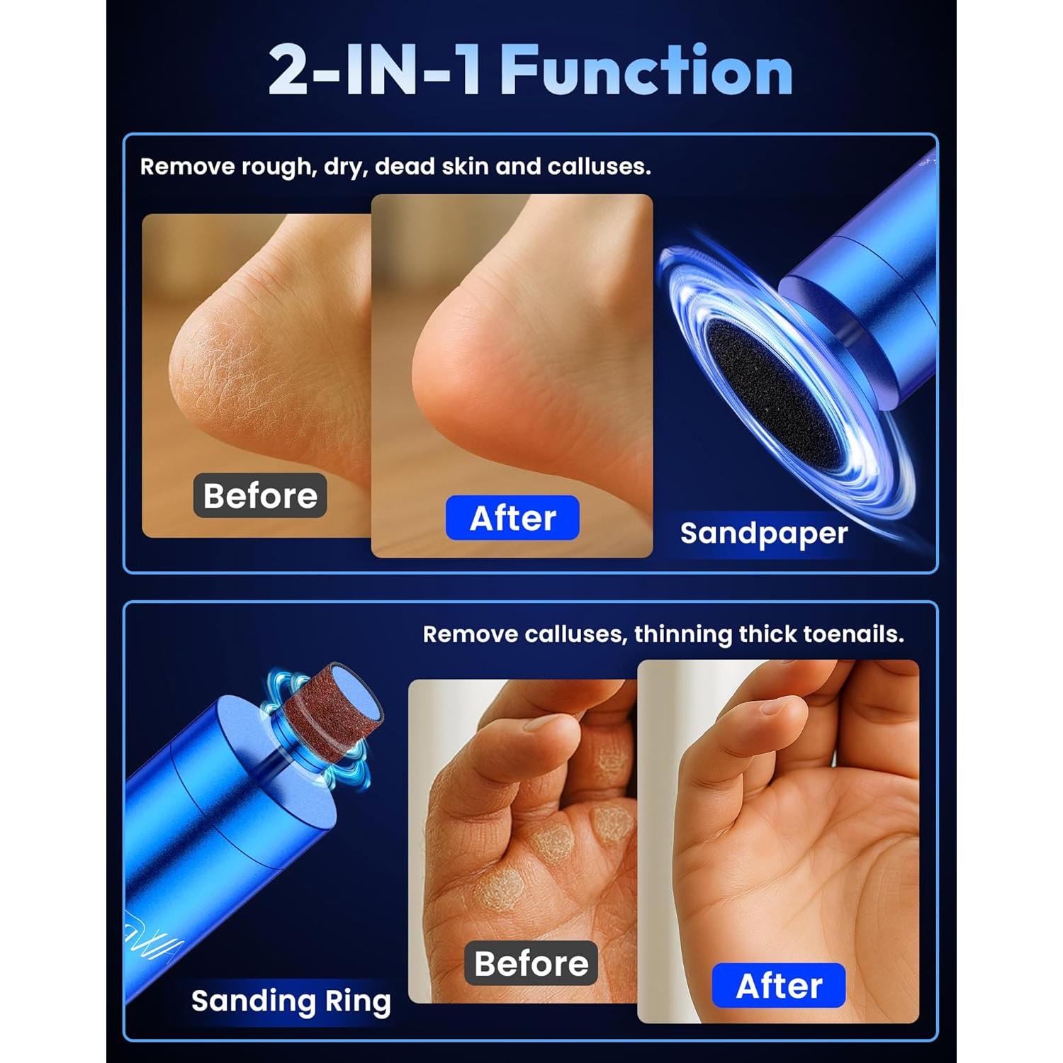 Removedor de Callos Eléctrico AWROSE 2600mAh Inalámbrico