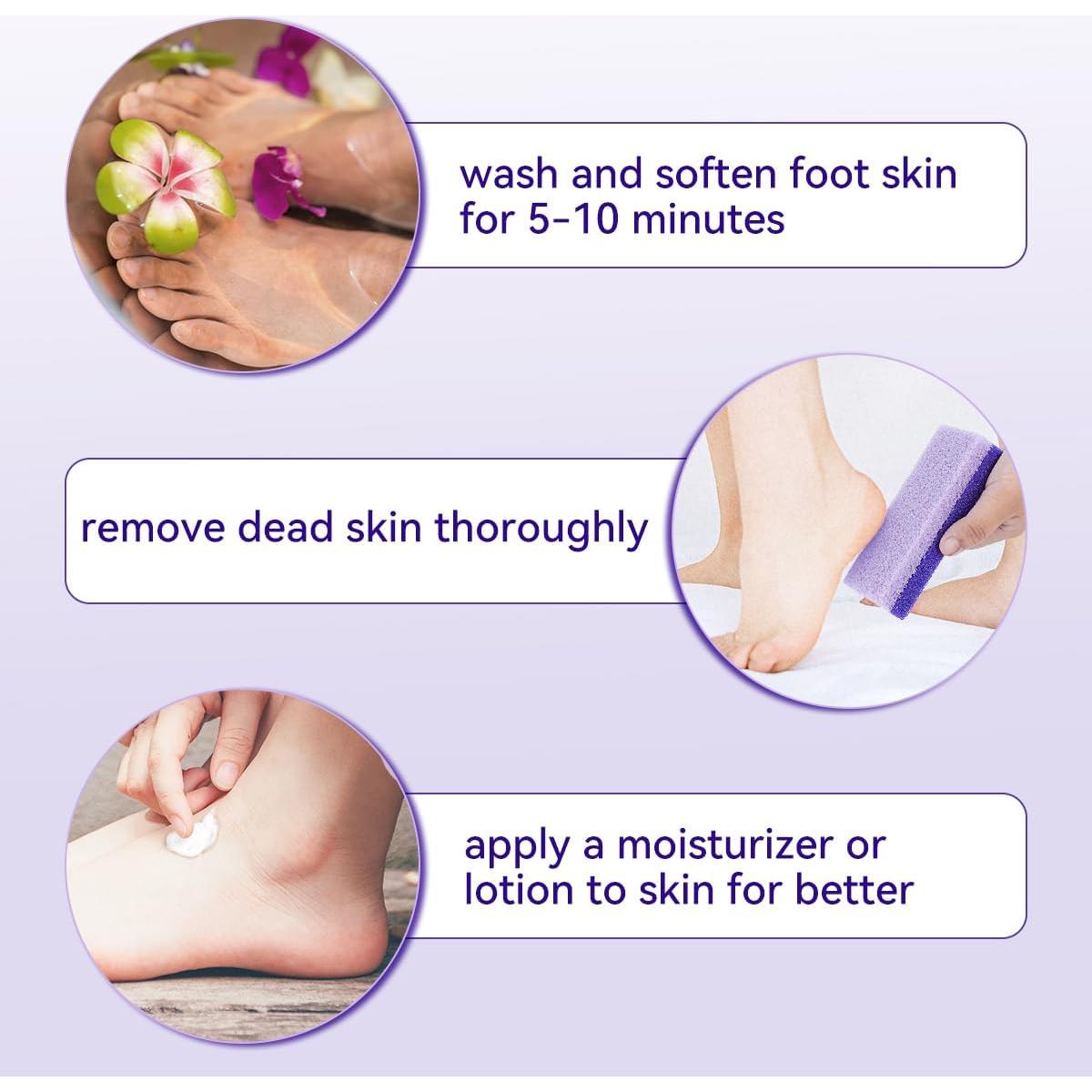 4 Piezas Piedra Pómez Exfoliadora para Pies y Talones Morado