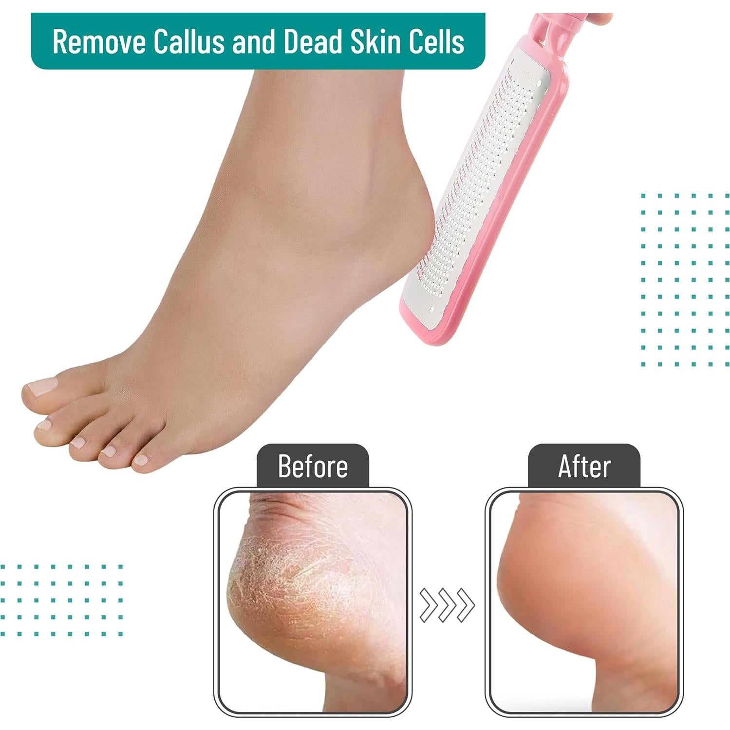 Removedor de Callos Slick Foot File Rosa - Lima de Acero Inoxidable