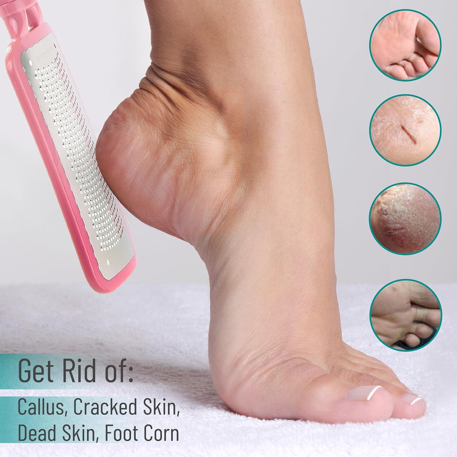 Removedor de Callos Slick Foot File Rosa - Lima de Acero Inoxidable