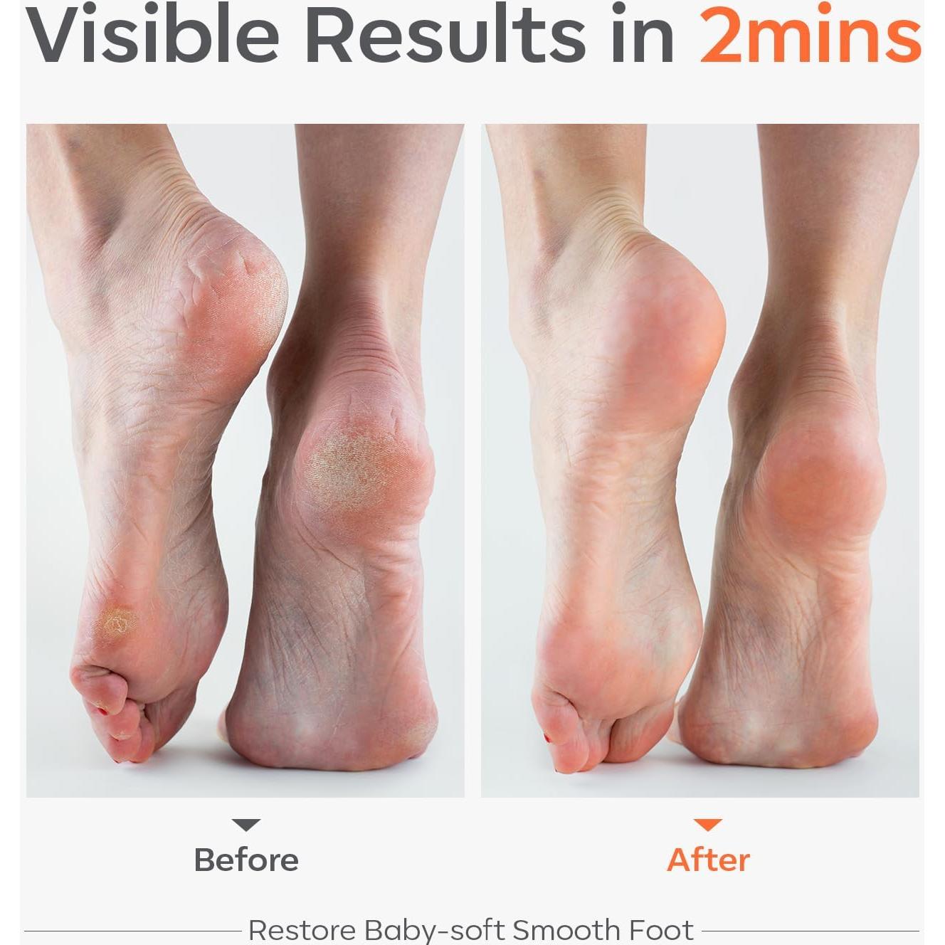 Lima de Vidrio Modelones para Pies - Exfoliador Profesional