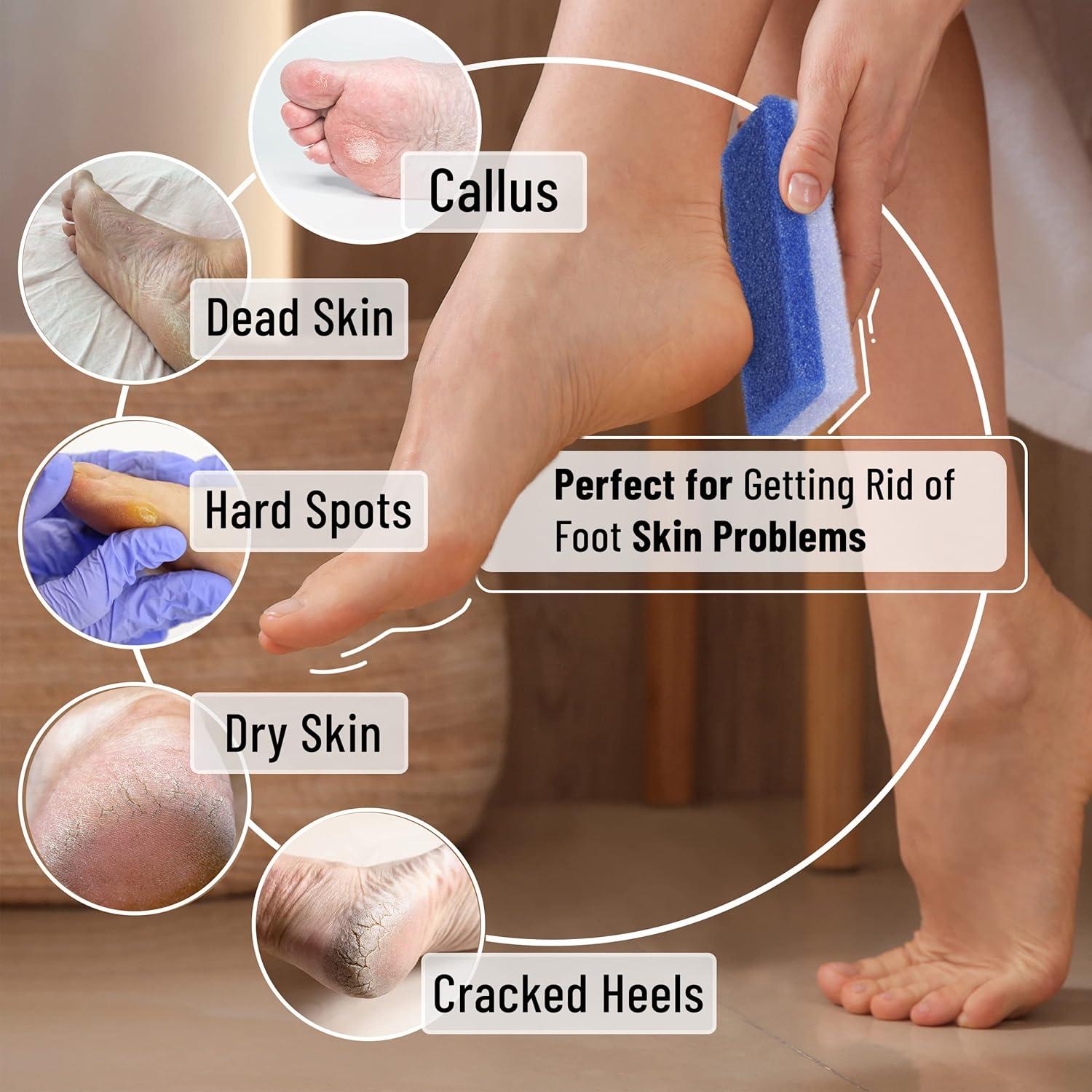 Piedra Pómez Slick para Pies - Removedor de Callos, 4 Unidades